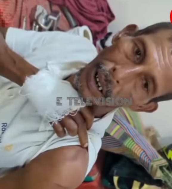 নড়াইল লোহাগড়ায় পারিবারিক কলহের জেরে স্ত্রী নিজে স্বামীকে কুপিয়ে হত্যা চেষ্টা