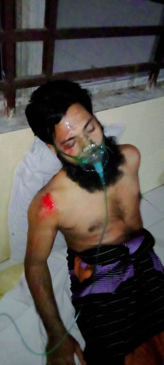 ঝিনাইদহে সড়ক দুর্ঘটনায় জামায়াত নেতা আবু হানিফ গুরুতর আহত
