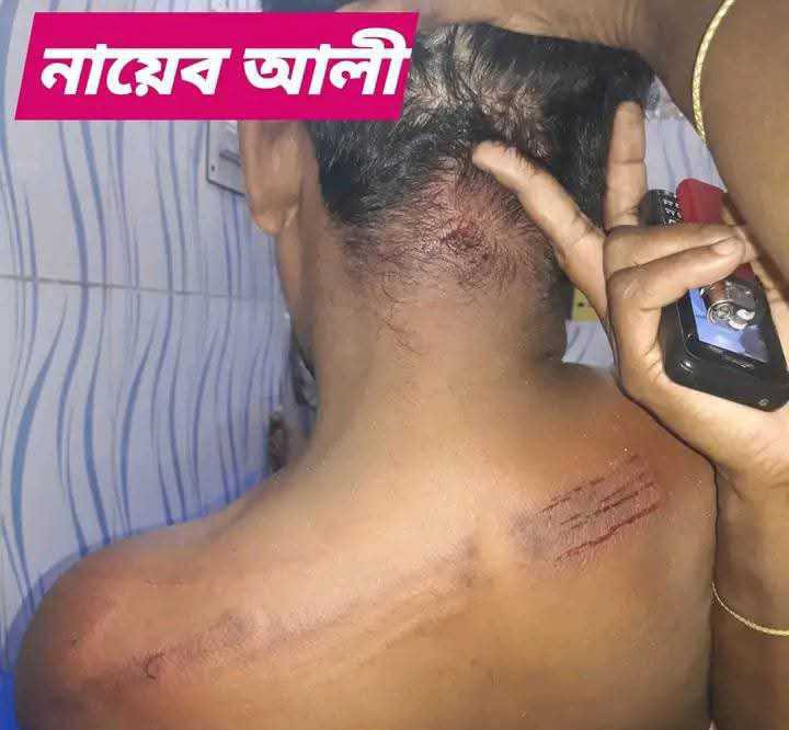 হরিণাকুন্ডু’তে মাদকাসক্ত ছেলের হাতে বাবা মারাত্মকভাবে আহত হয়ে হাসপাতালে ভর্তি