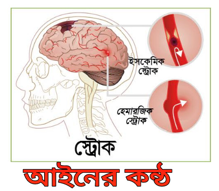 নিজের অবহেলায় ব্রেন ধ্বংস হচ্ছে।