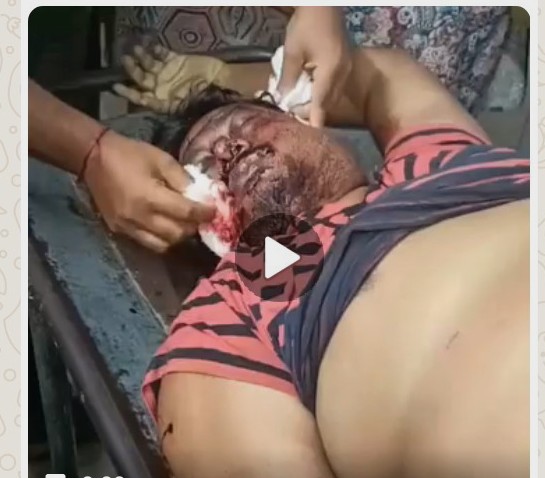 খুলনা যুবদল নেতাকে গুলি করে ও পায়ের রগ কেটে হত্যা