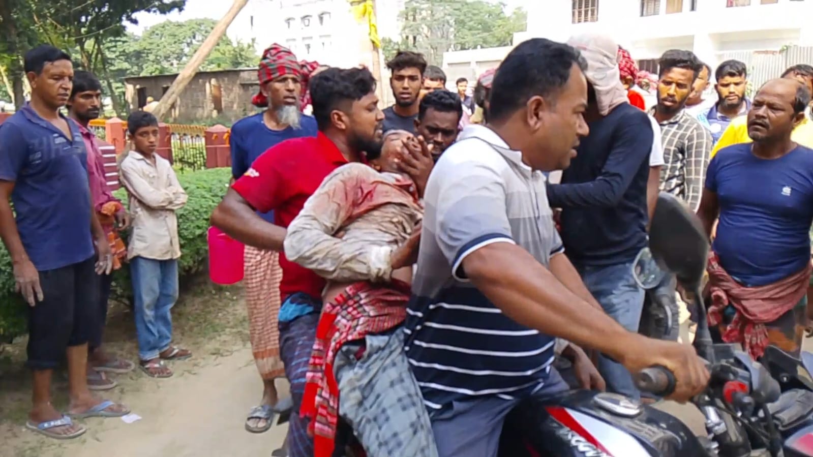 ইবিতে নির্মাণাধীন হলের কাজ চলাকালে বাঁশ ভেঙে পড়ে শ্রমিক আহত